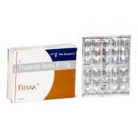 Finax (Finasteride 1mg)